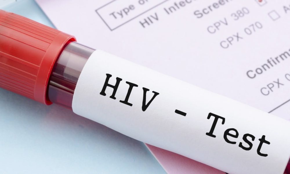 Akwa Ibom HIV rates skyrocket, raising concerns