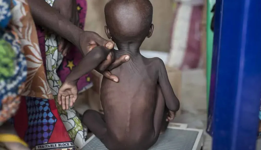 Hardship: Nigerian govt confirms over 4m children malnourished in Northeast, Northwest